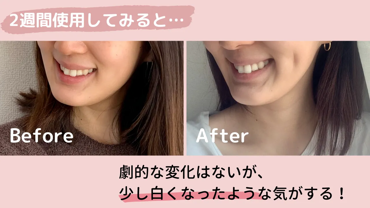 2週間使用してみると・・・劇的な変化はないが、少し白くなったような気がする!Before After